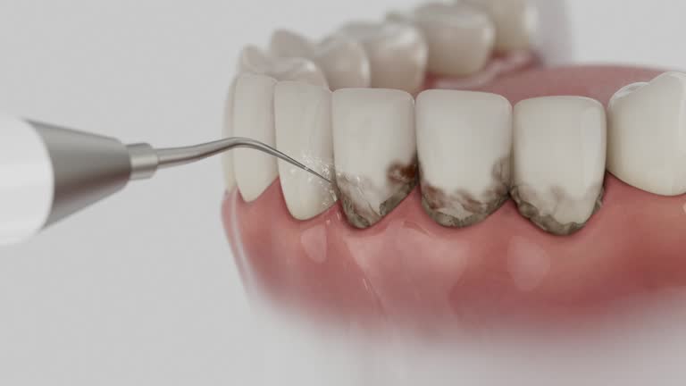 Trusted Invisalign Clear Aligners service in Petoskey, MI - Dentist Open Now